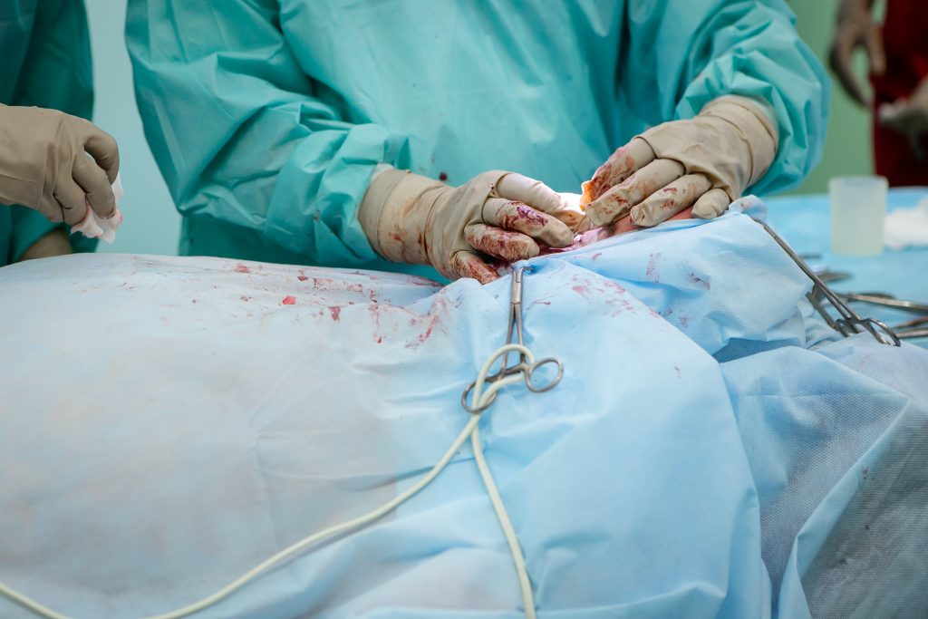 Apéndice Cecal: Anatomía, Función Y Relevancia 🎯 Olga Kononenko Ein4Rkoe R8 Unsplash Apéndice Cecal