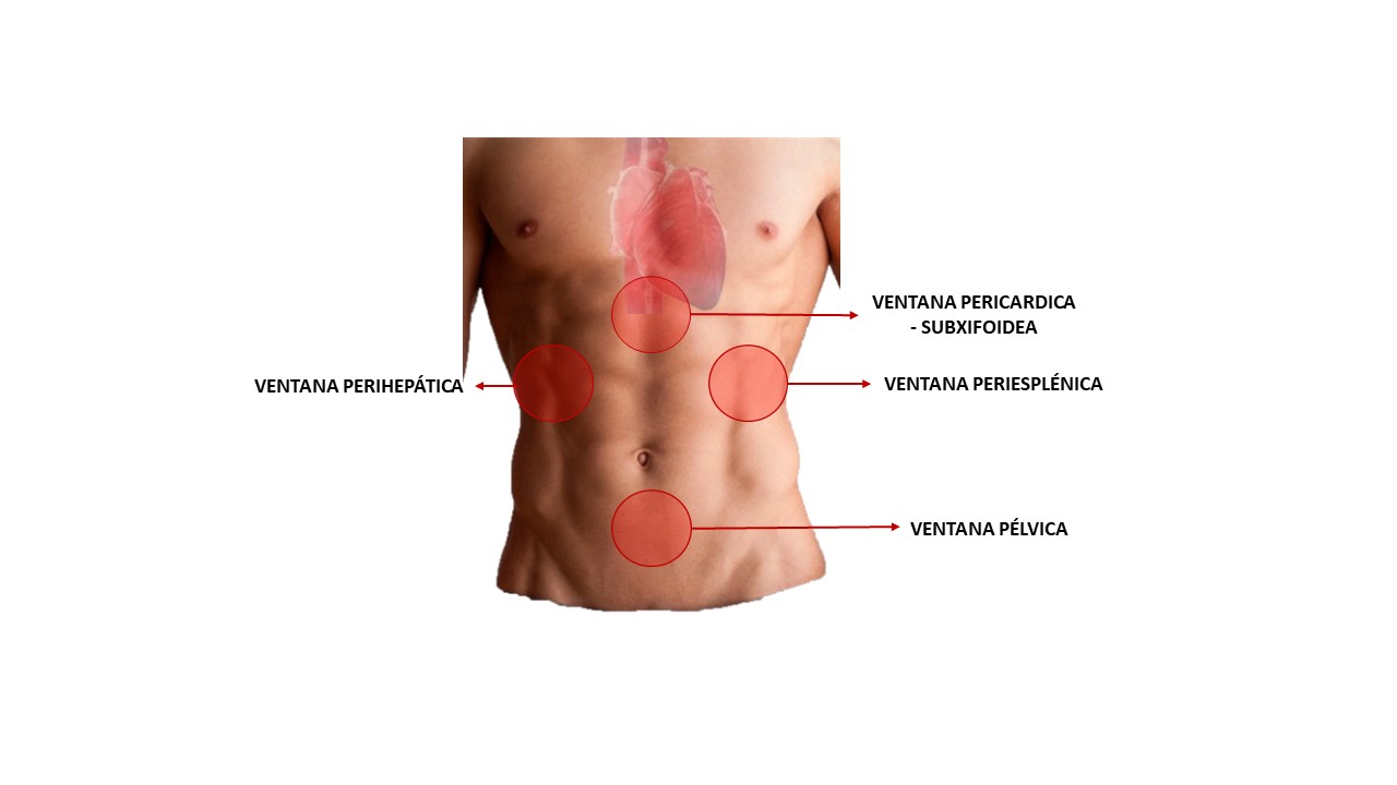 Traumatismo De Abdomen: Evaluación Atls, Tipos Y Manejo 🎯 E Fast 1 Esquema De Las 4 Ventanas Del Protocolo Ecográfico Fast En Trauma De Abdomen
