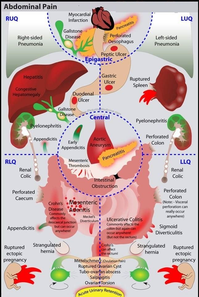Terapia Eficaz De Dolor Abdominal Agudo: Guía De Vanguardia Abdominal Pain Causes Abdominal Pain Causes Dr Jorge Delgado Cirujano